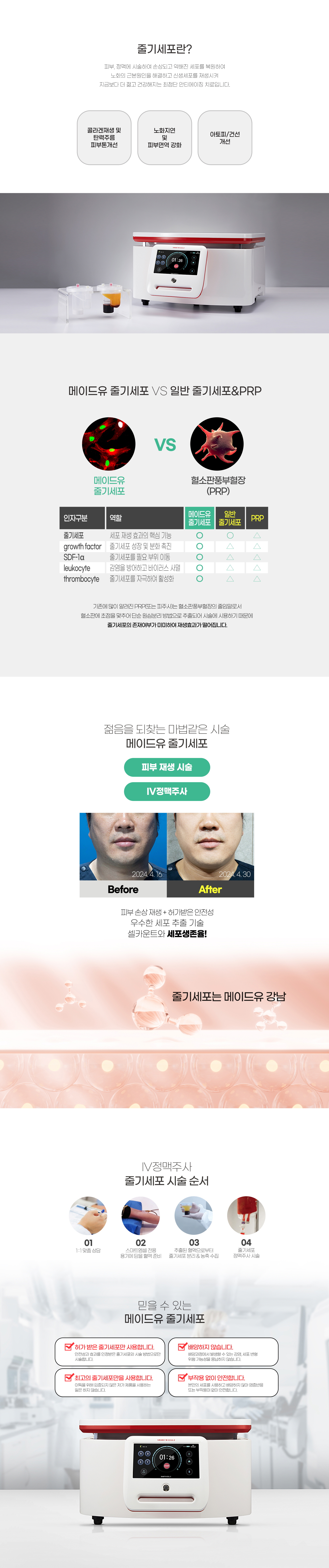 줄기세포주사 안내